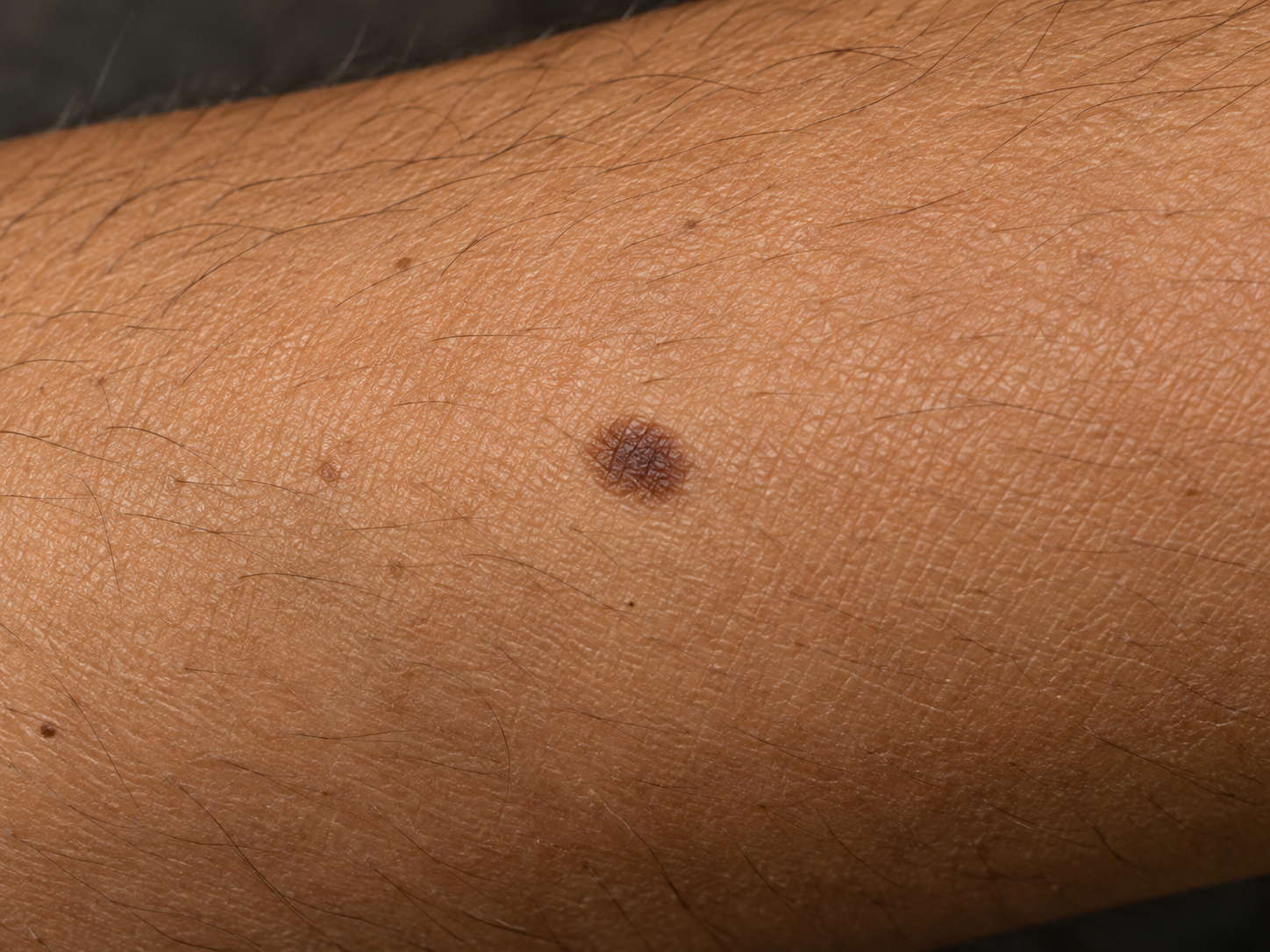 Close-up of a visible skin mark